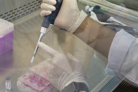 Δοκιμές ασφαλείας σε ανθρώπους για το υποψήφιο εμβόλιο της Johnson & Johnson κατά του κορονοϊού