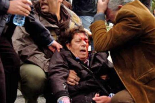 Οι… ατυχίες του επαγγέλματος