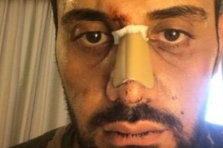 Ζητούνται απαντήσεις για τη δράση φασιστών