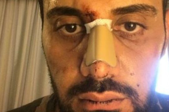 Ζητούνται απαντήσεις για τη δράση φασιστών