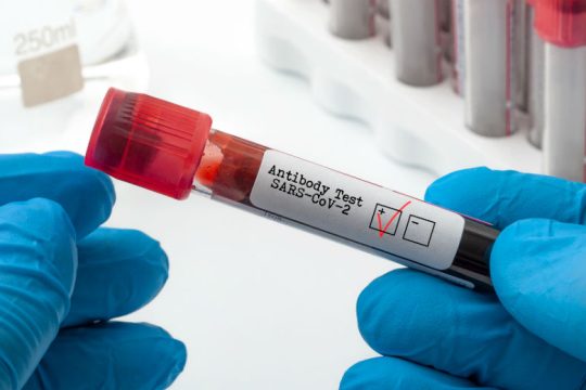 Και στην Ελλάδα θεραπείες με πλάσμα ιαθέντων ασθενών με Covid-19