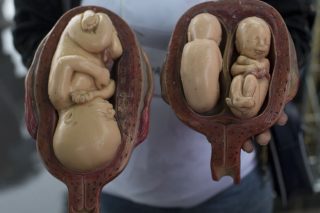 Φασίστες Βραζιλιάνοι εμπόδιζαν άμβλωση σε βιασμένη 10χρονη!