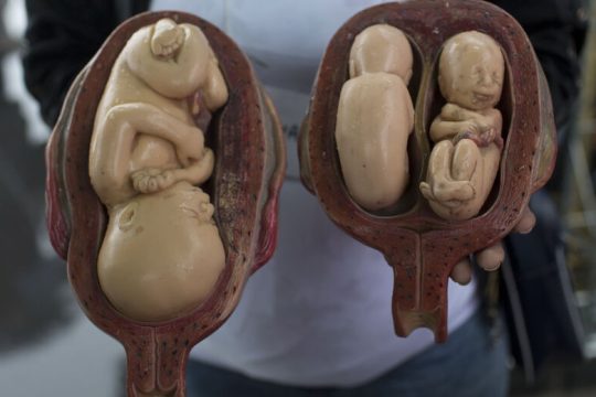 Φασίστες Βραζιλιάνοι εμπόδιζαν άμβλωση σε βιασμένη 10χρονη!