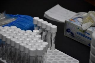Μεγάλη υστέρηση της Ελλάδας στα τεστ