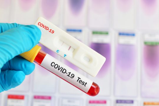 Έντεκα κρούσματα σε εργοστάσιο με 150 εργαζομένους στο Κορωπί