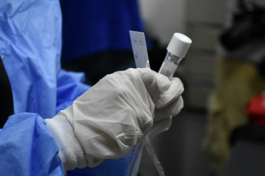 Ξεπέρασαν τα 300 τα κρούσματα του κορονοϊού, 67 οι διασωληνωμένοι