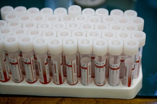 Επιστροφή σε τετραψήφιο αριθμό κρουσμάτων