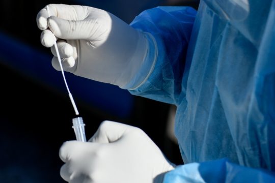 Αθήνα: Κρούσματα covid-19 στο προσωπικό της Εφορείας Αρχαιοτήτων