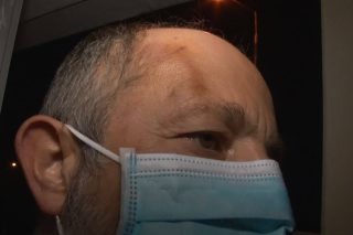 Ηράκλειο: Επίθεση σε δημοτικό αστυνομικό λόγω… προστίμου