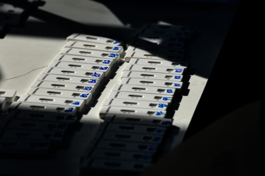 Aνησυχητικές αποκαλύψεις για την αξιοπιστία των rapid test