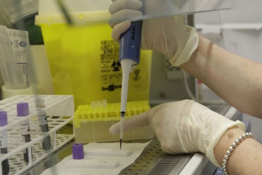 Ιταλός πέθανε ώρες μετά τον εμβολιασμό γιατί ως ασυμπτωματικός είχε πολλά αντισώματα