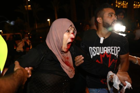 «Φρένο» στις εξώσεις Παλαιστινίων βάζει η αυξανόμενη ένταση στην Ιερουσαλήμ