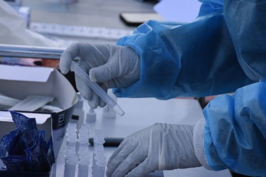 Μόσιαλος: Το εμβόλιο δεν μας προστατεύει όλους από την παραλλαγή Δέλτα  