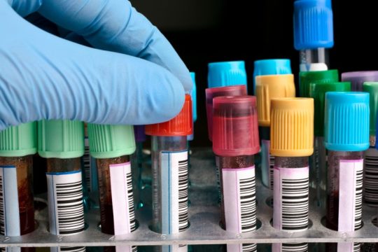 Τα εμβόλια Covid-19 είναι λιγότερο αποτελεσματικά σε ασθενείς με πολλαπλό μυέλωμα