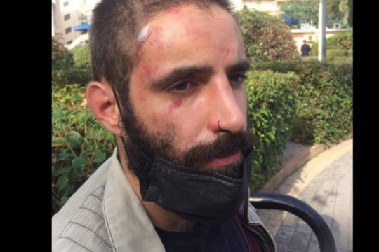 ΚΕΕΡΦΑ: Επίθεση τάγματος εφόδου σε μέλος του ΣΕΚ με κλωτσιές στο κεφάλι και το σώμα
