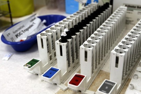 Απεργία των ιδιωτών εργαστηριακών γιατρών έως τις 30 Νοεμβρίου