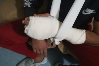 Κατήγγειλε ξυλοδαρμό, πήγαν να τον απελάσουν