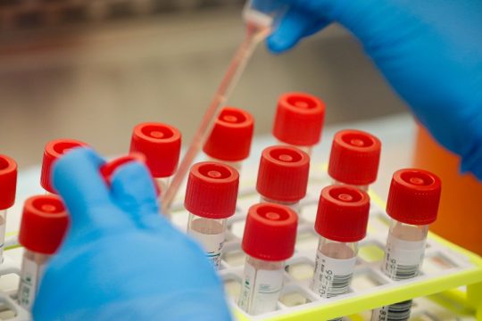Σχεδόν ένας στους 100 Αμερικανούς άνω των 65 πέθανε λόγω Covid-19