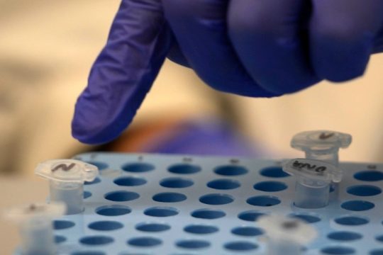 Το Πανεπιστήμιο της Οξφόρδης αναζητά εθελοντές σε έρευνα για να κολλήσουν κορονοϊό