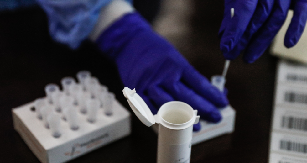 Η ΚΥΑ για τα rapid test και τη νόσηση στην εργασία