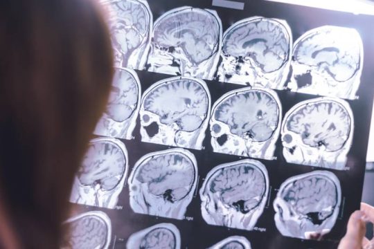 Κίνδυνος για άνοια μετά από πολλές χρόνιες παθήσεις στη μέση ηλικία