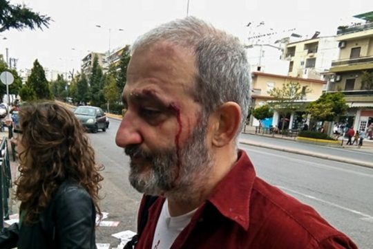 Την Παρασκευή η δίκη για τη φασιστική επίθεση εις βάρος μελών της ΚΕΕΡΦΑ στο Γαλάτσι
