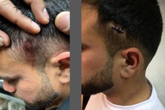 Καταγγελία για ρατσιστική επίθεση κατά μετανάστη από οδηγό ταξί στο κέντρο της Αθήνας