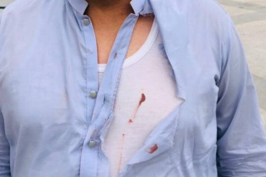 Καταγγελία για νέα ρατσιστική επίθεση φασιστών