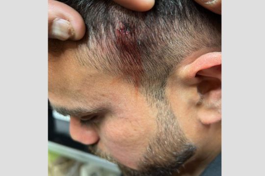 Καταγγελία για φασιστικό χτύπημα στον Αγιο Παντελεήμονα