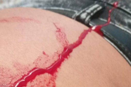 Ρατσιστική επίθεση κατά Πακιστανού στον Κόκκινο Μύλο καταγγέλλει η ΚΕΕΡΦΑ