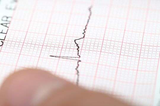 Δόνηση 5 Ρίχτερ ταρακούνησε την ανατολική Τουρκία