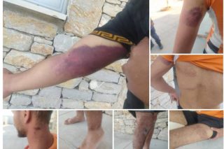 ABR: Βασανισμοί προσφύγων στο Φαρμακονήσι, νέα επαναπροώθηση ανοιχτά της Λέσβου