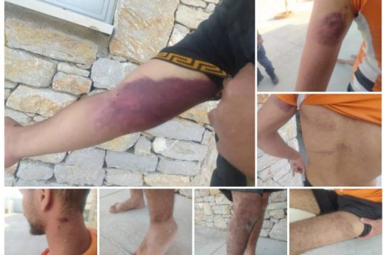 ABR: Βασανισμοί προσφύγων στο Φαρμακονήσι, νέα επαναπροώθηση ανοιχτά της Λέσβου