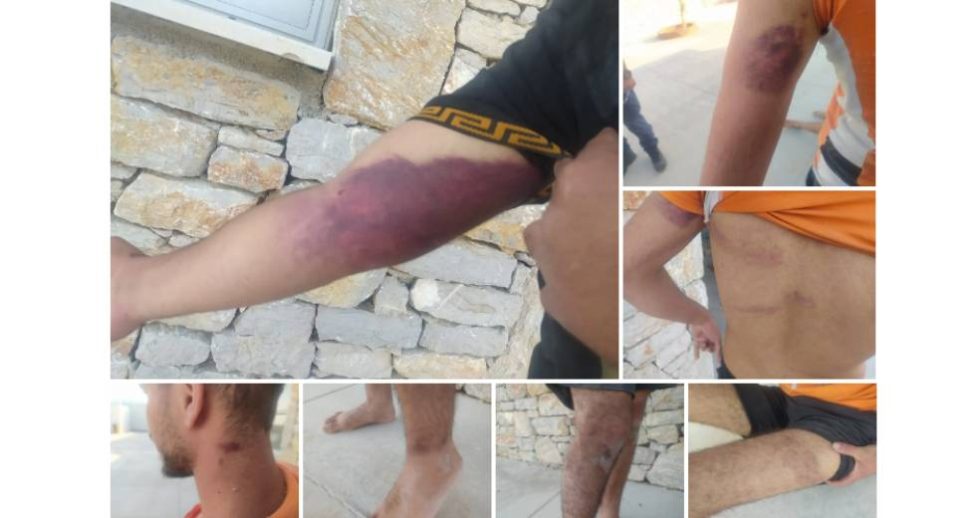 ABR: Βασανισμοί προσφύγων στο Φαρμακονήσι, νέα επαναπροώθηση ανοιχτά της Λέσβου