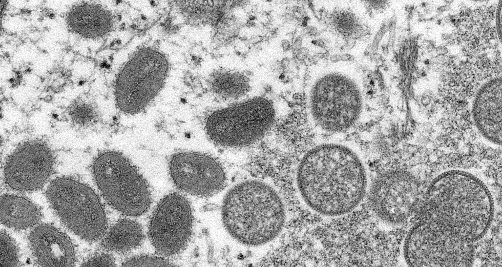 CDC για ευλογιά των πιθήκων: Χαμηλός ο κίνδυνος για τη δημόσια υγεία