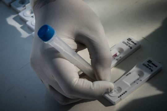 Μικρή αποκλιμάκωση κρουσμάτων Covid-19, 17 νέοι θάνατοι
