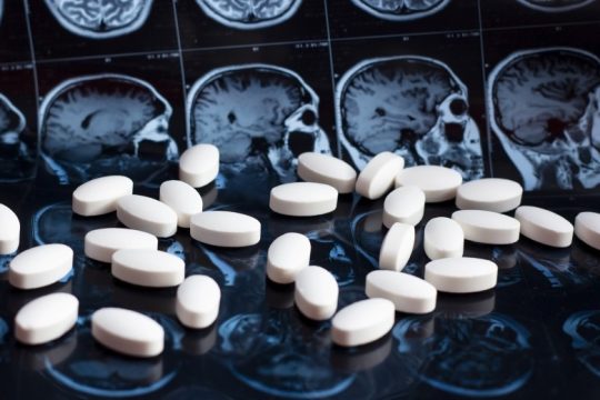 Ποινική έρευνα εις βάρος φαρμακευτικής για παραπλανητικά στοιχεία σχετικά με φάρμακο για το Αλτσχάιμερ