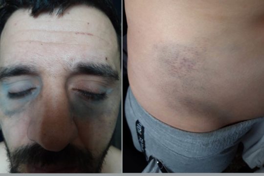 Τον χτυπούσαν ανελέητα μπροστά στους γονείς του