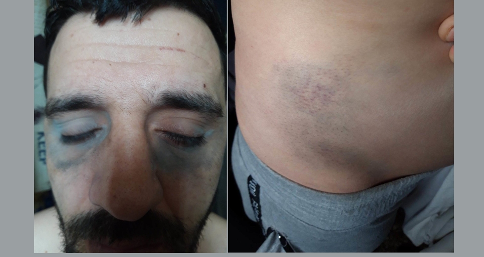 Τον χτυπούσαν ανελέητα μπροστά στους γονείς του