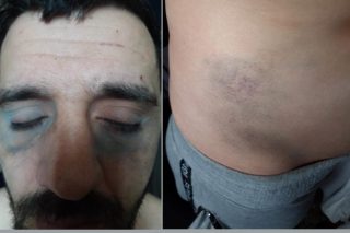 «Ασύλληπτοι αστυνομικοί του Α.Τ. Καβάλας που ξυλοκόπησαν το Σίμο»  