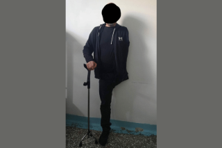 Ακρωτηριασμένος κρατείται χωρίς να έχει καταδικαστεί