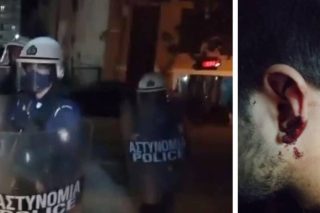 Αστυνομικός στο σκαμνί για ξυλοδαρμό αναρχικού
