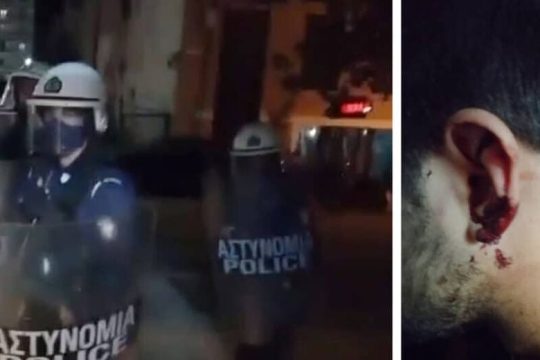 Αστυνομικός στο σκαμνί για ξυλοδαρμό αναρχικού