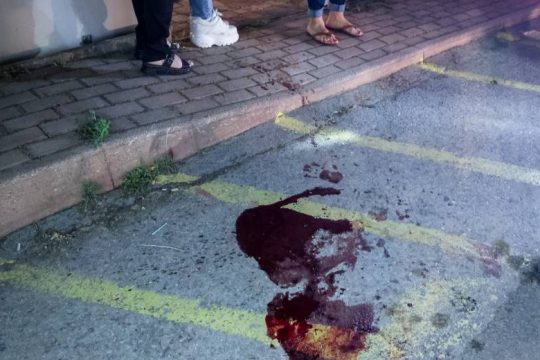 Βγήκε απ’ τη ΜΕΘ η γυναίκα που δέχτηκε μαχαιριές απ’ τον σύντροφό της