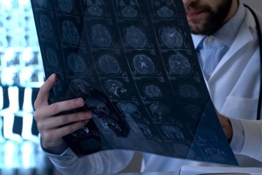 Εργαλείο τεχνητής νοημοσύνης αποκωδικοποιεί το γονιδίωμα του καρκίνου του εγκεφάλου