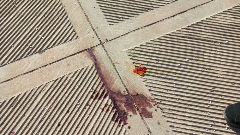 Πολυτεχνειούπολη, αστυνομική βία