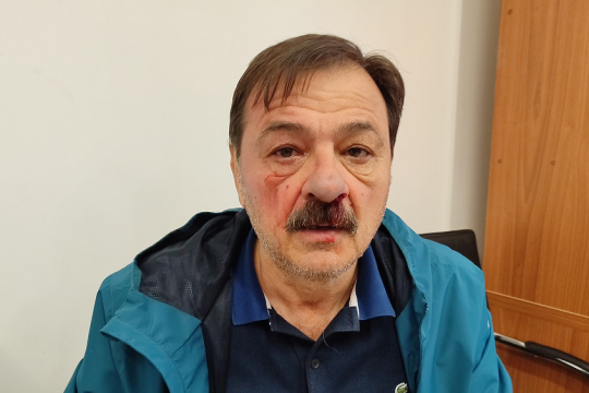 To θύμα ξυλοδαρμού Κώστας Γαργάλας