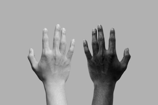 racism