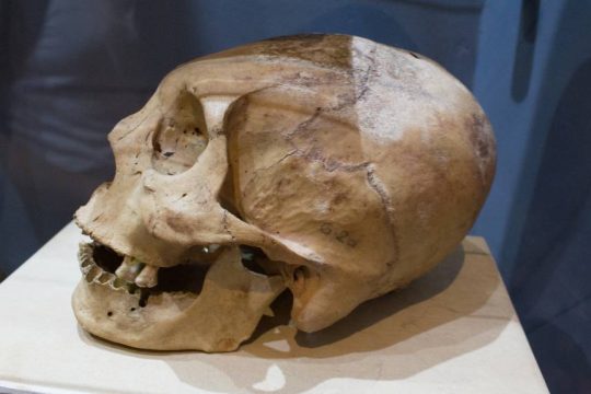 kranio