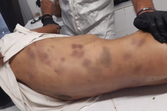 Μετανάστης νεκρός